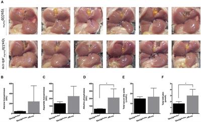 Metabolomics and Lipidomics Reveal the Effect of Hepatic Vps33b Deficiency on Bile Acids and Lipids Metabolism